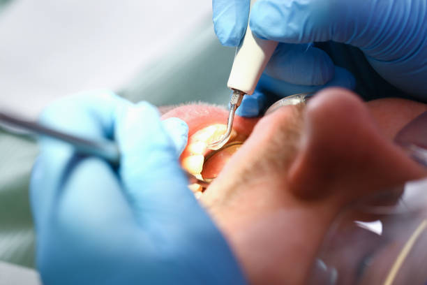 Best Broken or Cracked Tooth Emergency Dentist in Warrenton, VA